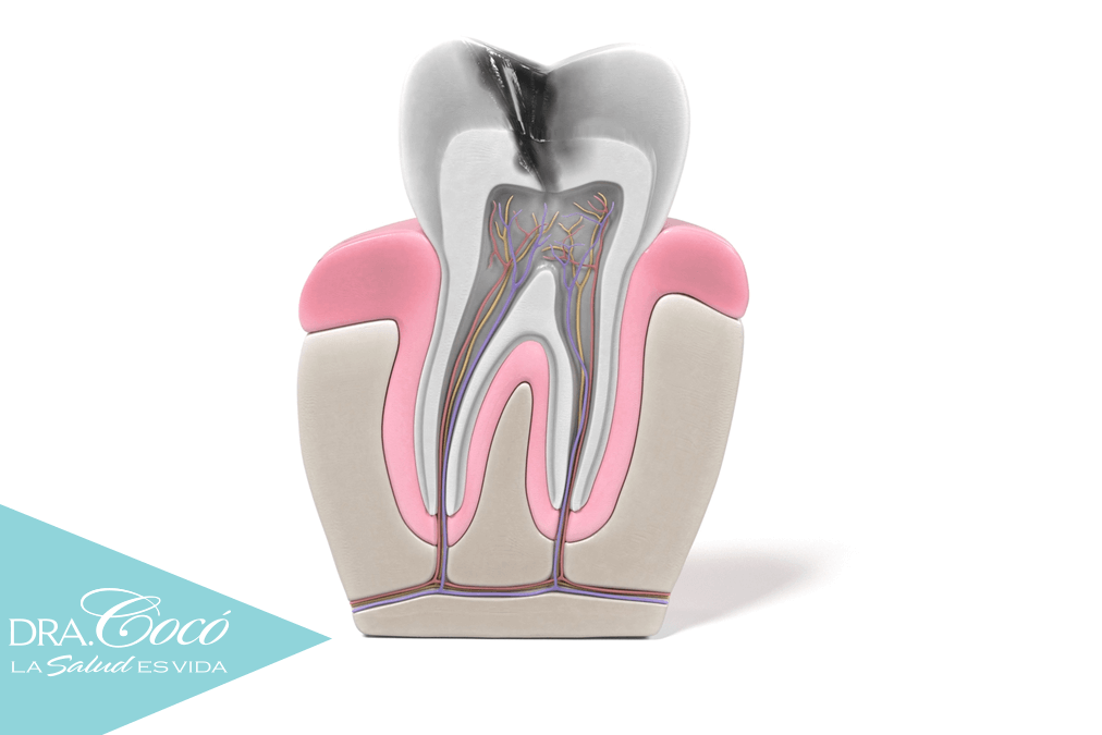 alternativas-a-la-endodoncia