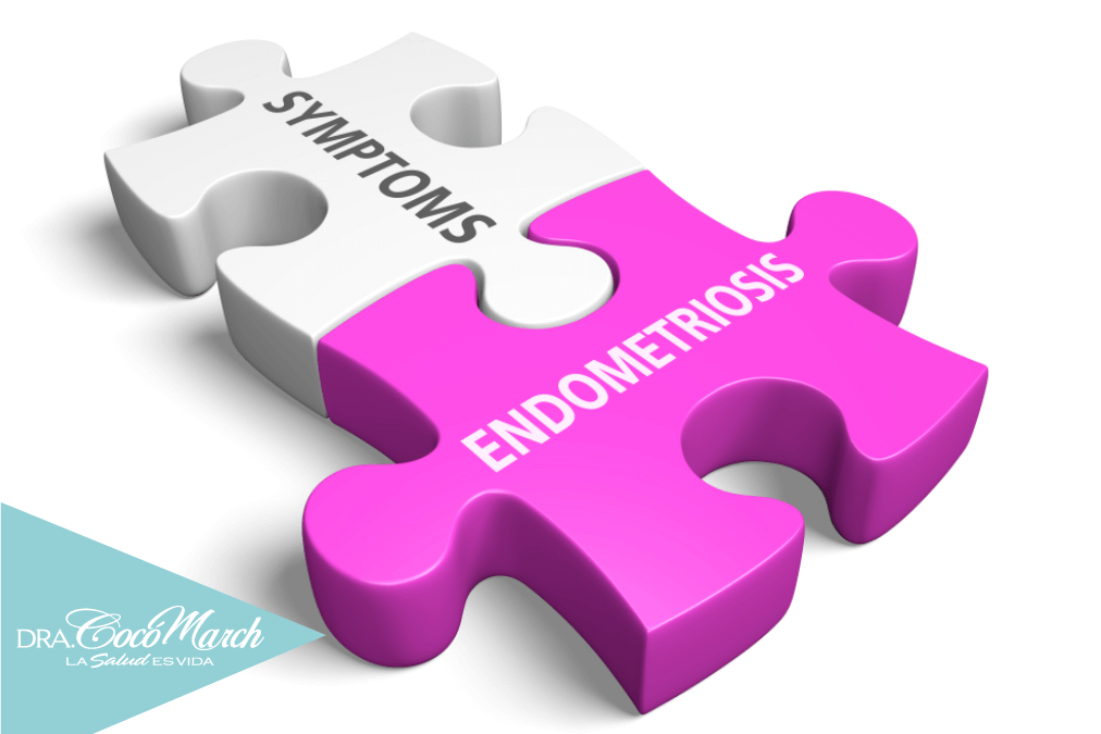 síntomas-y-tratamiento-de-la-endometriosis