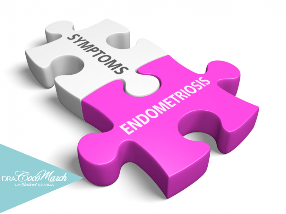 síntomas-y-tratamiento-de-la-endometriosis