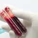 test-de-sangre-puede-detectar-varios-tipos-de-cáncer