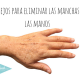 cómo-quitar-manchas-de-las-manos-de-forma-natural