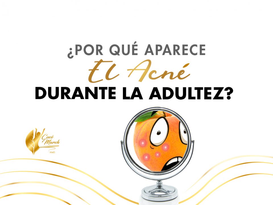 por-que-aparece-acne-durante-adultez