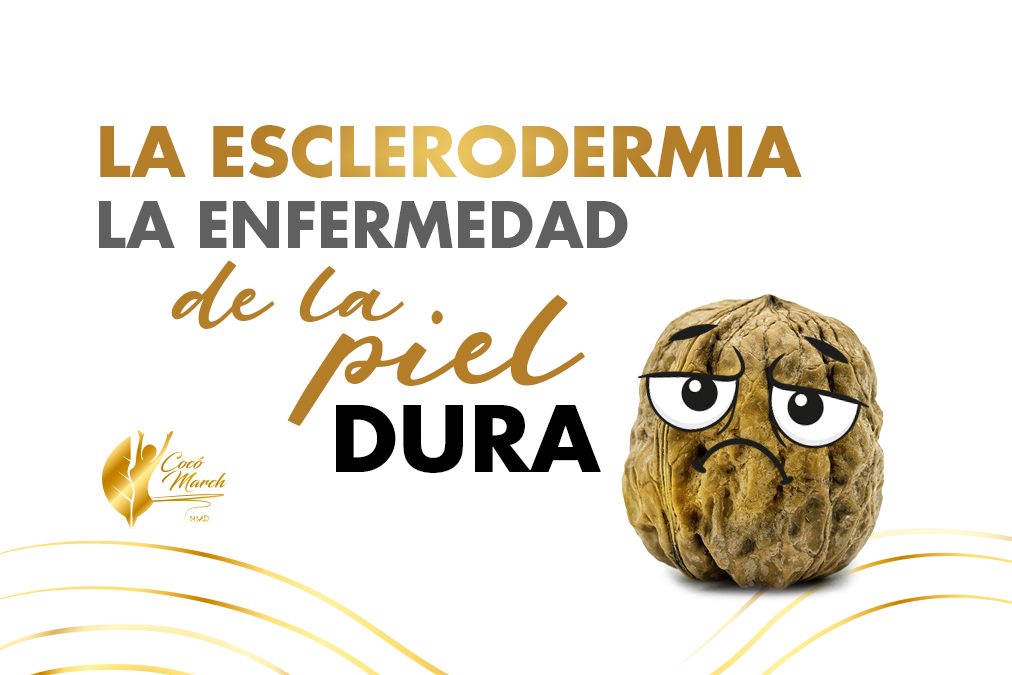 esclerodermia-localizada