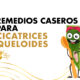 4 Remedios Caseros Para Cicatrices Queloides | Coco March
